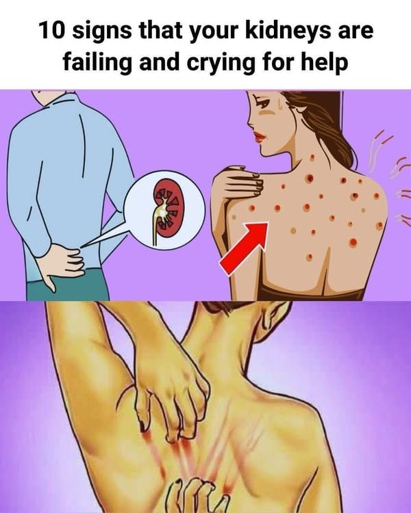 10 Warning Signs Your Kidneys May Be in Danger…