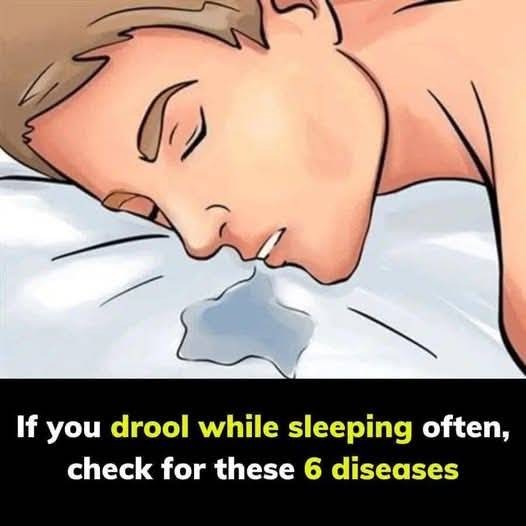 Could Your Drooling Be a Sign of a Health Problem?