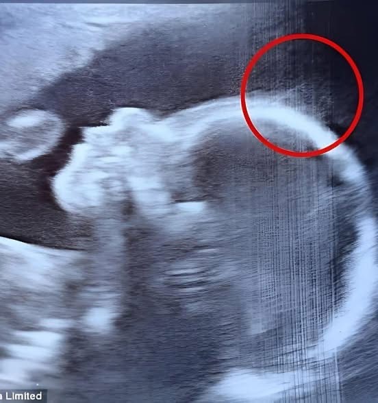 The ultrasound revealed unusual contours, and now everyone is amazed by this little girl.😮😂😂