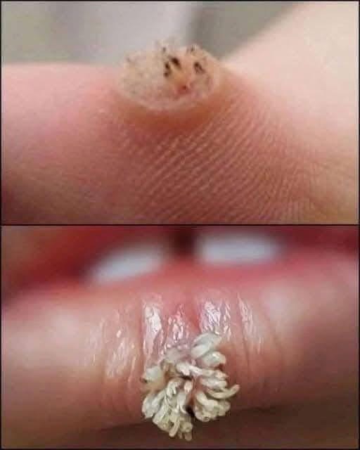 BE VERY CAREFUL 🚨. If you get this, you are infected with