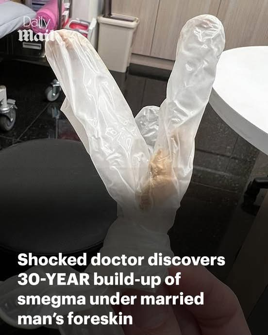 Shocked doctor discovers 30-YEAR build-up of smegma under the foreskin of married man who was suffering agonising pain in his penis