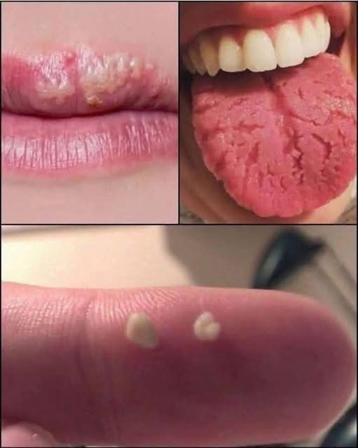 BE CAREFUL, if you get these bruises on your body, it means you have Ca…