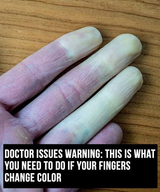 Doctors warn of disease if your fingers and toes change color in cold