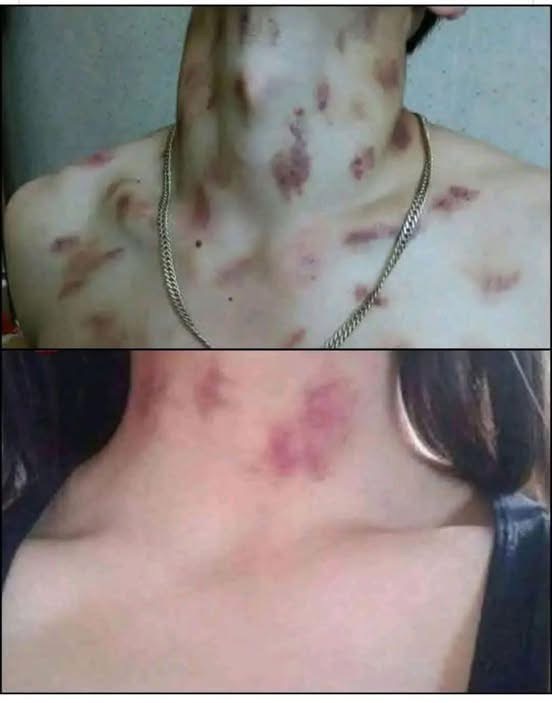 If your partner makes you these chu… See more