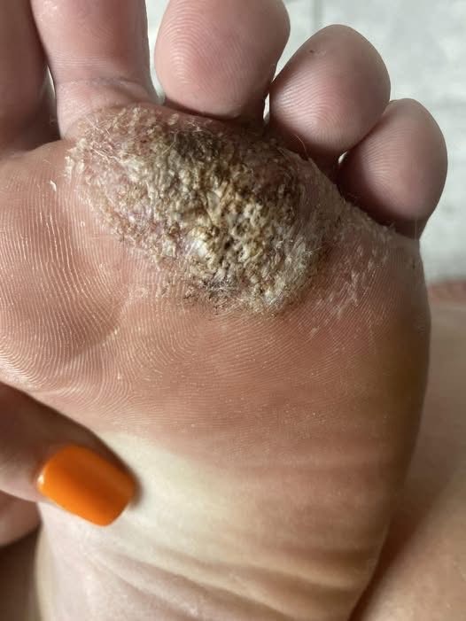 BE VERY CAREFUL 🚨. If you get this, you are infected with …. See more