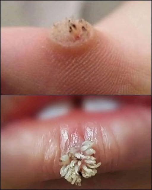 BE VERY CAREFUL 🚨. If you get this, you are infected with