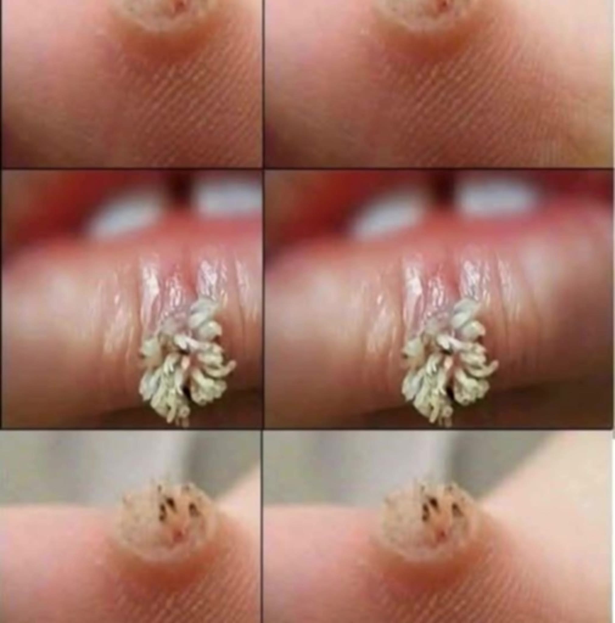 To BE VERY CAREFUL. If you get this, you are infected with ….