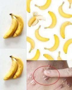 BE CAREFUL, if you get these bruises on your body, it means you have Ca…see more