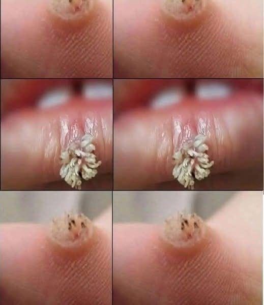 BE VERY CAREFUL 🚨. If you get this, you are infected with …. See more