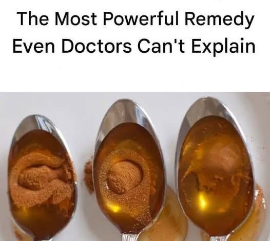 Cinnamon and Honey: Nature’s Power Duo Doctors Still Can’t Fully Explain