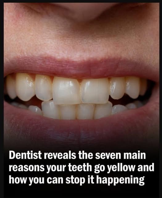 Dentist Explains 7 Key Causes of Yellowing Teeth and How to Prevent It