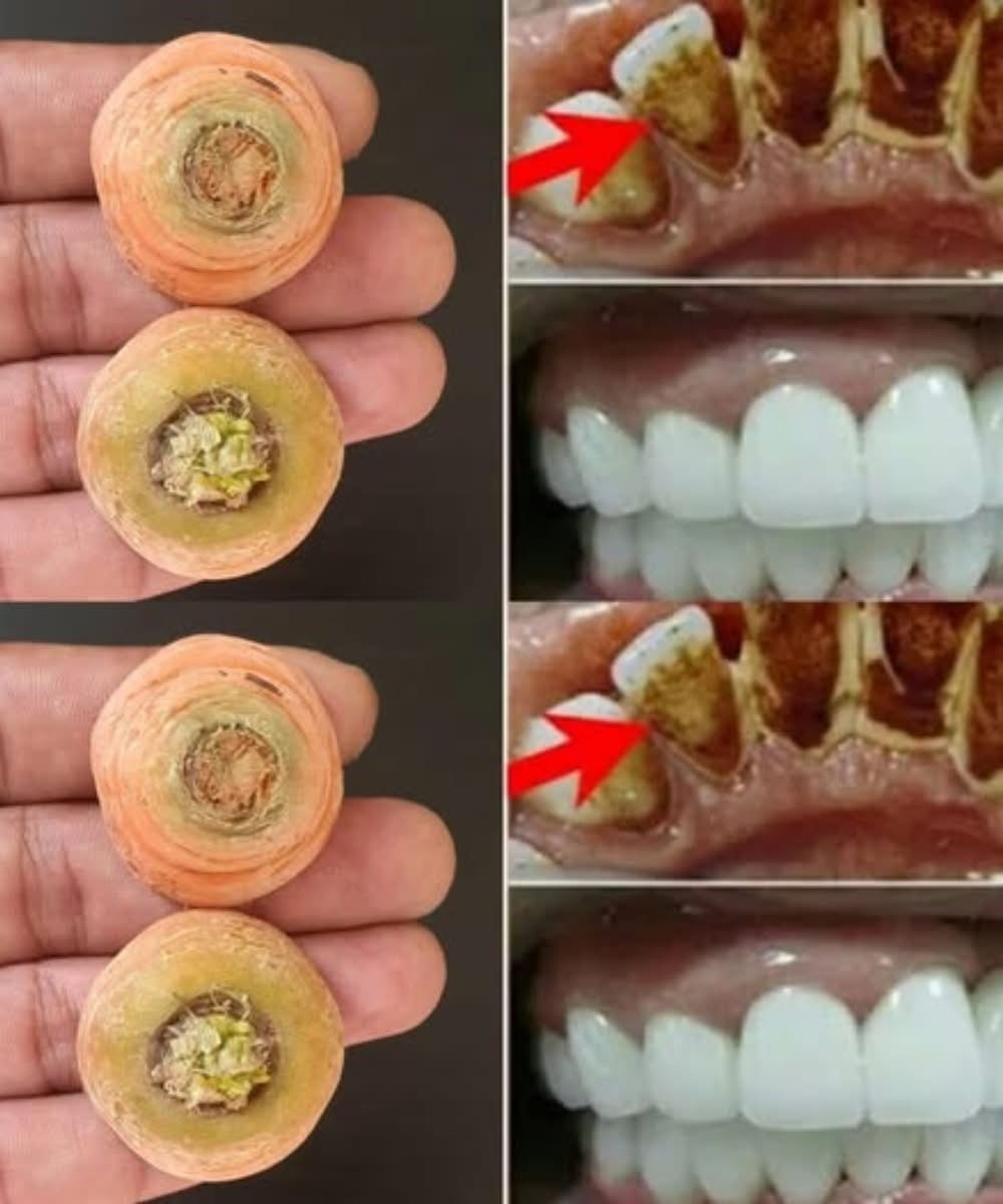 Brighten Your Smile Naturally with Carrot Ends: A Simple Home Remedy for Teeth Whitening