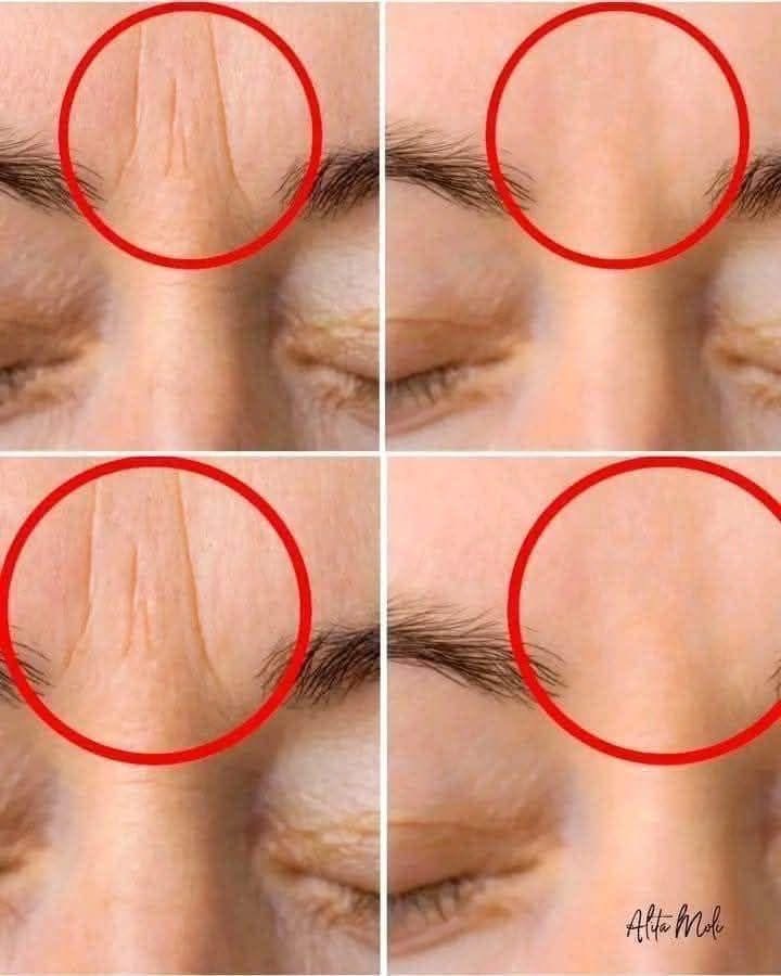 😲If you get wrinkles on your forehead you should know that… See more