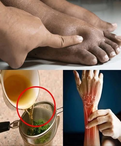 1-TG Drink This Tea & Say Goodbye to Swollen Legs, Ankles & Feet!