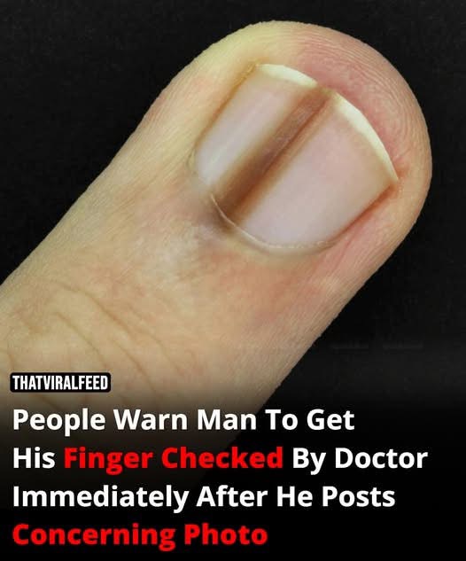 Man Urged To See Doctor After Sharing Photo Of His Finger That Has People Worried