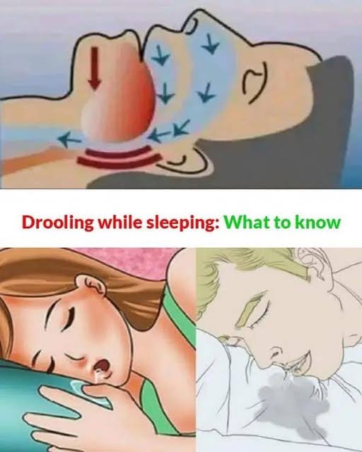 If you dr00l while you sleep, this is what your health might be warning you about.