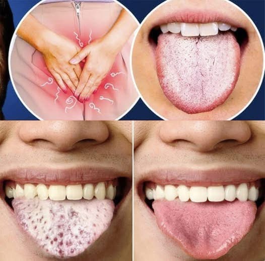 What Your Tongue Can Tell You About Your Health: 4 Symptoms You Shouldn’t Ignore