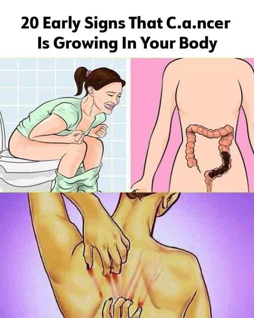 20 Subtle Signs Your Body Might Be Fighting Cancer: What You Should Never Ignore