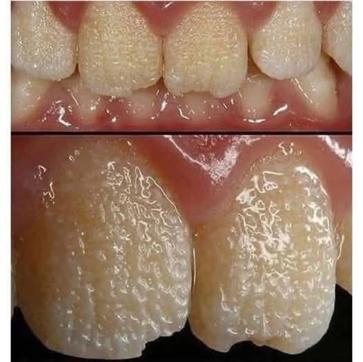 Be careful!! This is what your teeth will become when you eat…see more