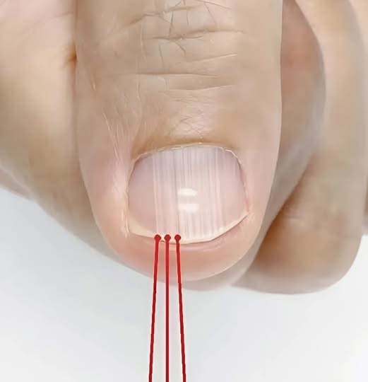 What vertical lines on your nails really mean – the truth will surprise you
