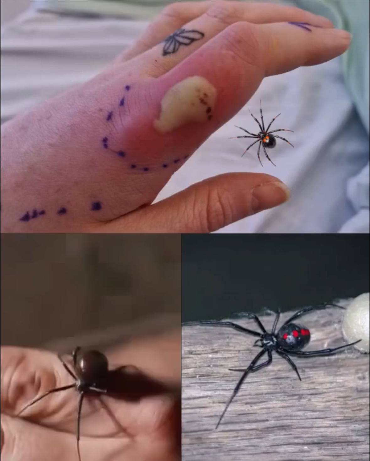 What To Do If You Get Bit.ten By A Black Widow Spider: A Complete Guide