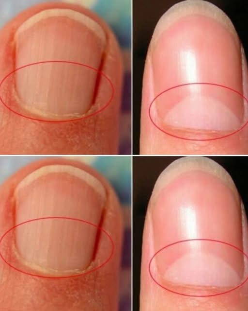 What Does the Half-Moon at the Base of Your Nails Really Mean?
