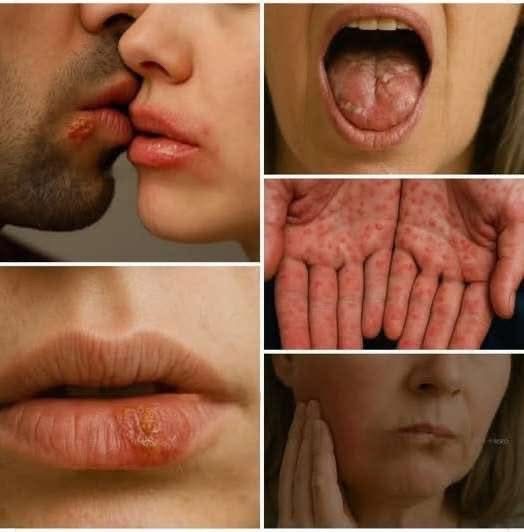 Don’t Underestimate It: Recognizing The Early Signs Of Oral Can…