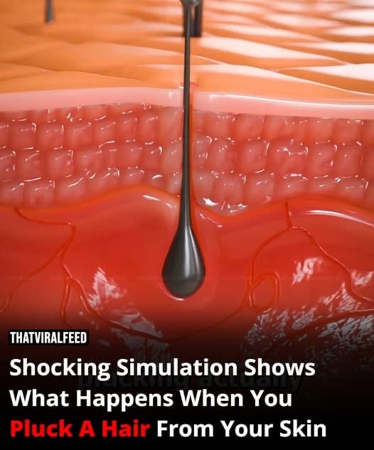 Shocking Simulation Reveals The Effects Of Plucking A Hair From Your Skin