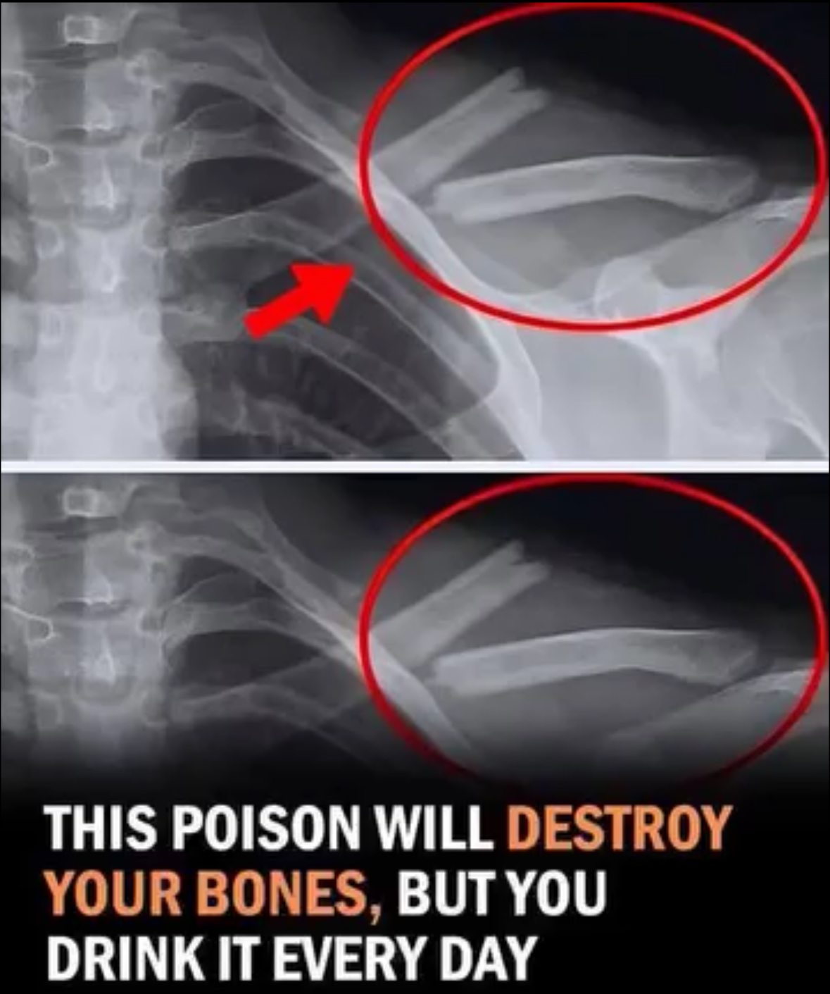 Ditching Diet Soda? Here’s What Really Happens to Your Body