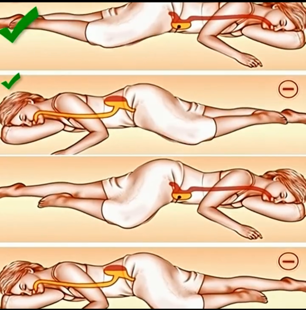 Unlocking the Remarkable Benefits of Left-Side Sleeping