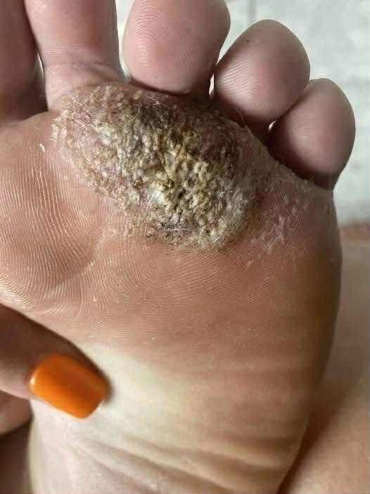 BE VERY CAREFUL . If you get this, you are infected with …. See more