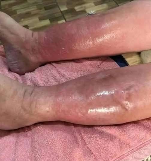 Signs on your FEET that indicate he is cr… see more
