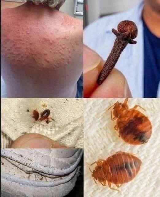 Young woman dies at the hands of her…See moreIt was itching his body, he thought it was an allergy, but a tough diagnosis… See more