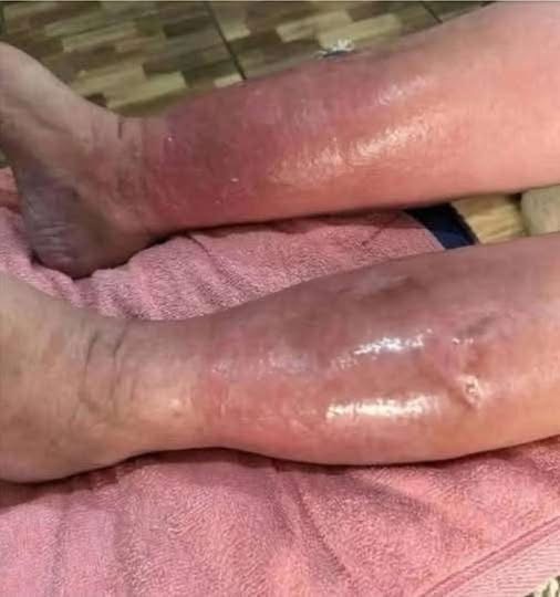 HT10. Health Warning Signs on Your Feet You Should Never Ignore