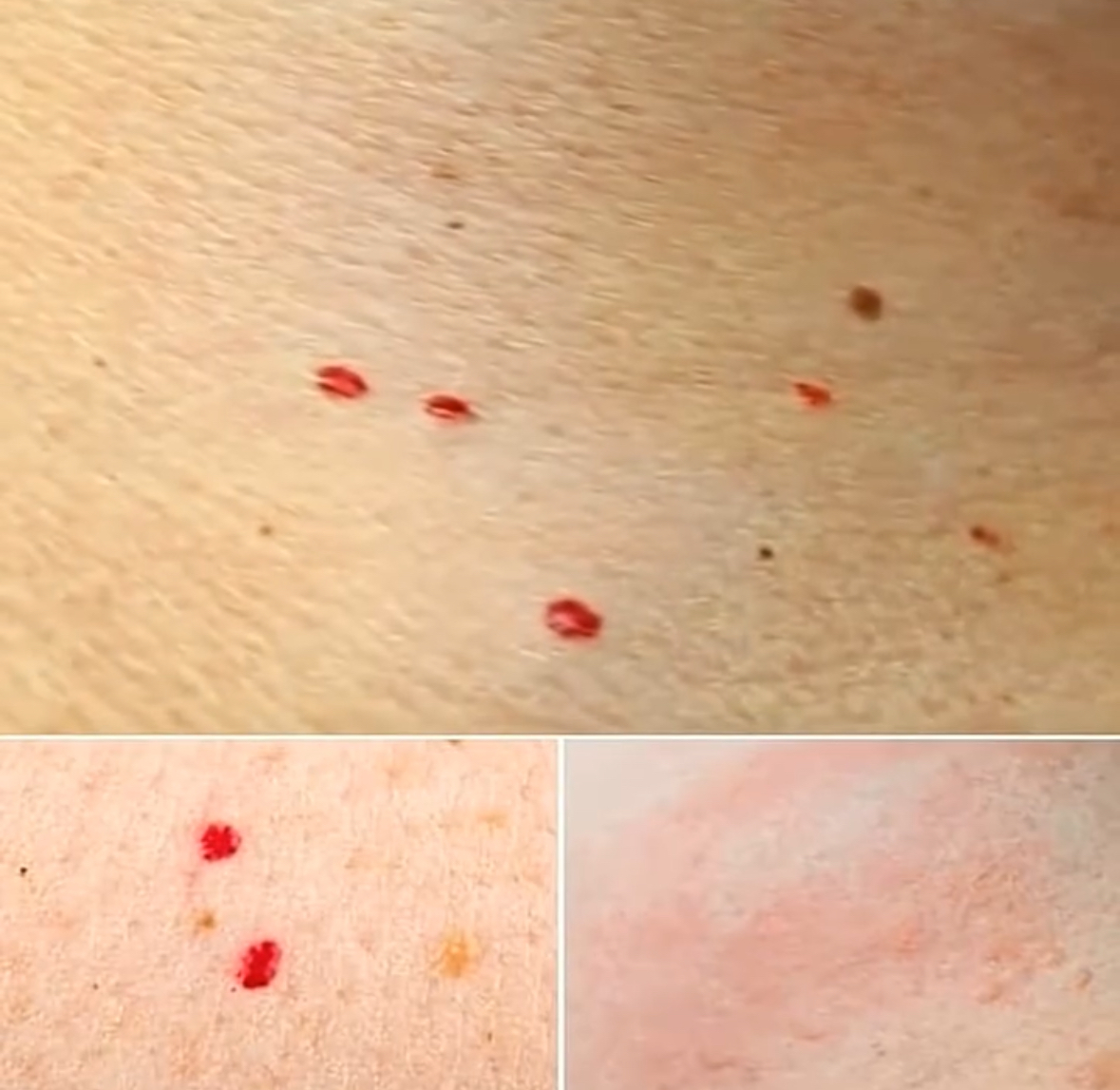 What Those Mysterious Red Dots on Your Skin Could Mean