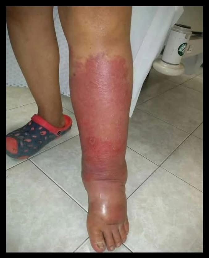 😲❌Health Warning Signs on Your Feet You Should Never Ignore