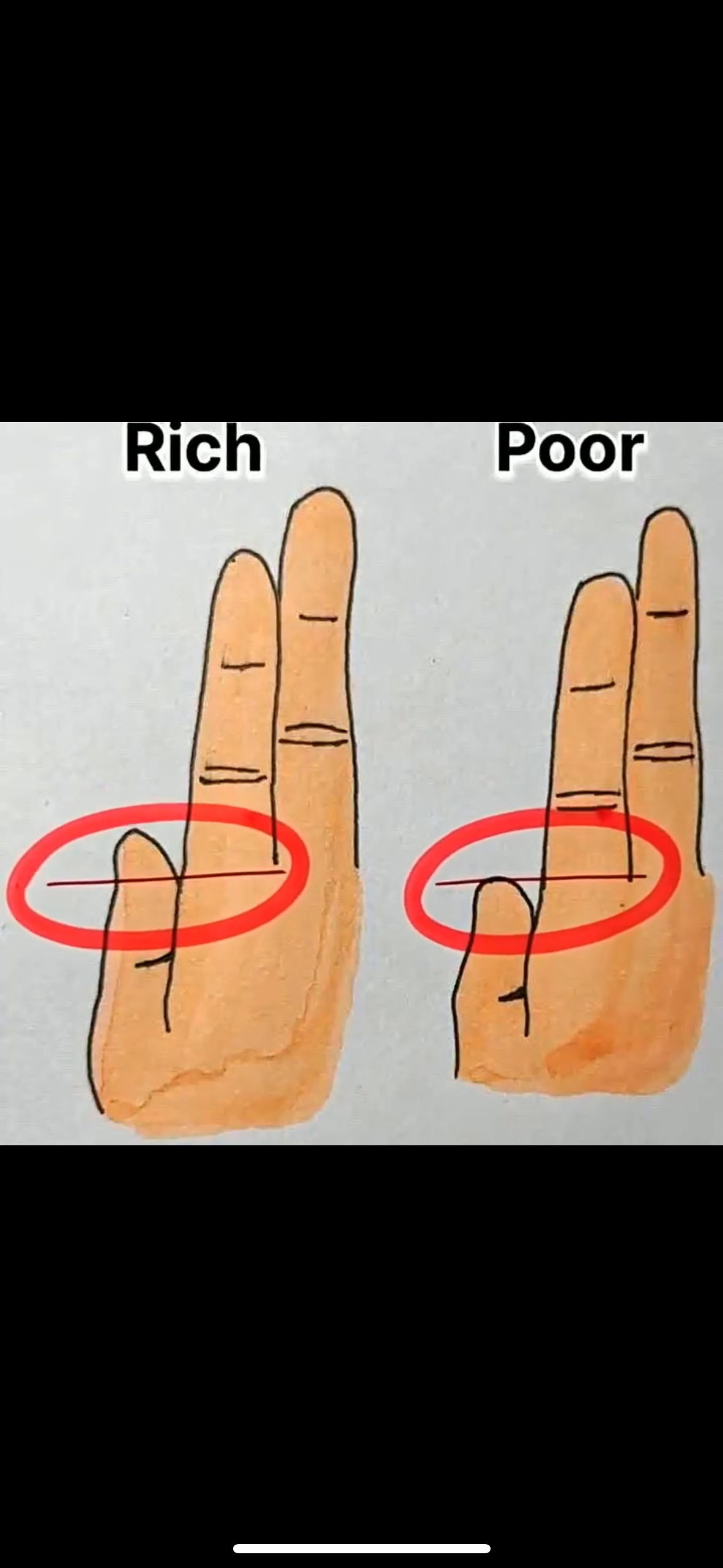 Your Fingers Could Reveal Whether You’re Rich or Poor