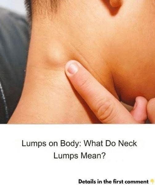 This Lump May Appear Due To Something You Do Every Day