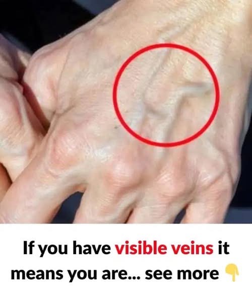 When To Worry About Suddenly Visible Veins: What Your Body May Be Telling You