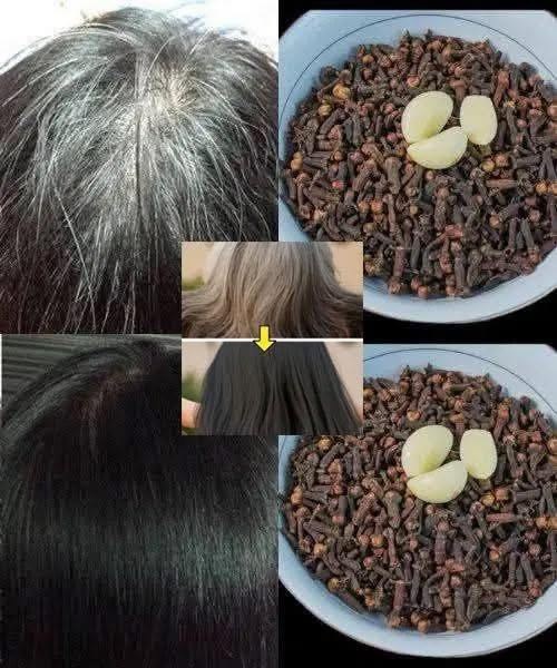 How Garlic and Clove Can Help Reverse Hair Graying Naturally