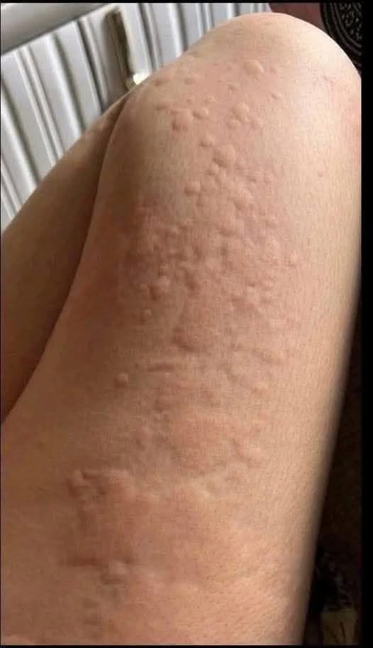 He Thought It Was Just an Allergy – The Diagnosis Surprised Him