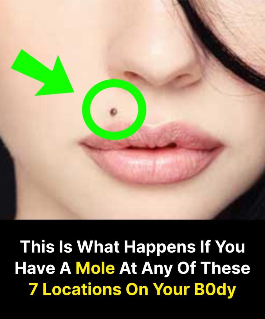 This Is What Happens If You Have A Mole At Any Of These Seven Locations On Your Body