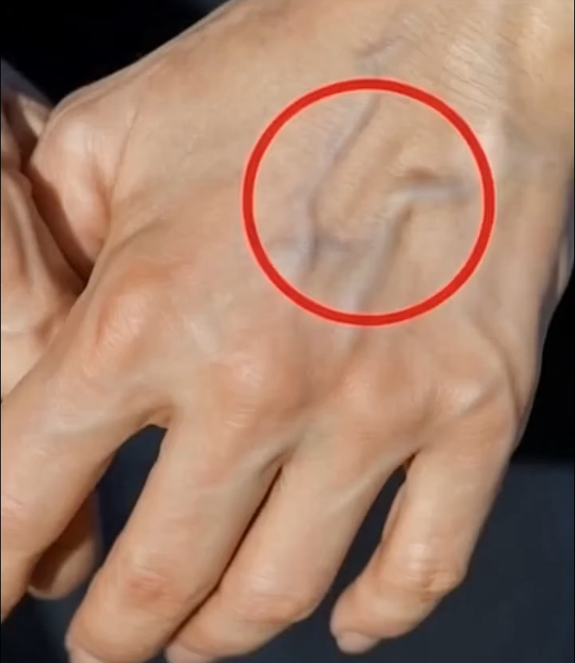 Natural Remedies to Improve the Health of Your Veins and Skin