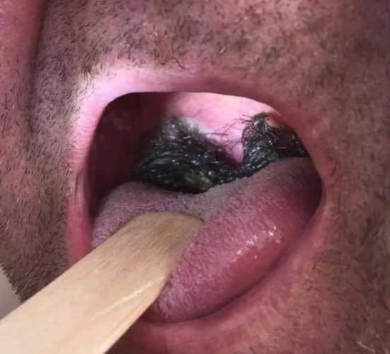 These Are The Consequences Of Sleeping With…See More