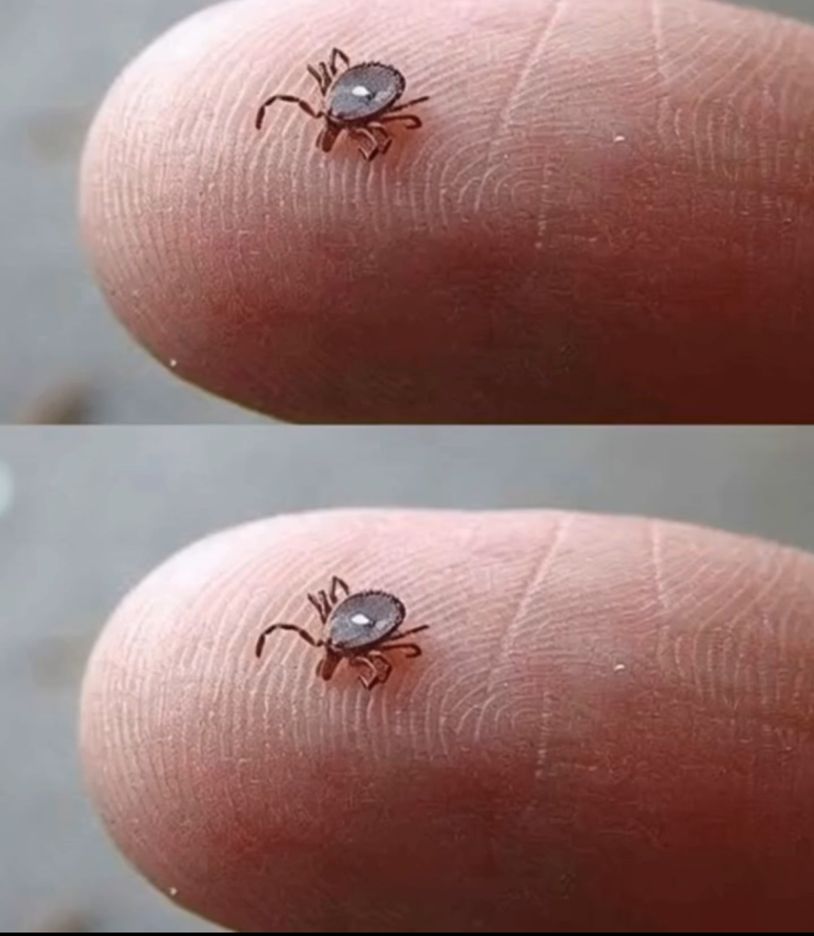 Lone Star Tick Bites: Dangers, Symptoms, And Urgent Steps To Take