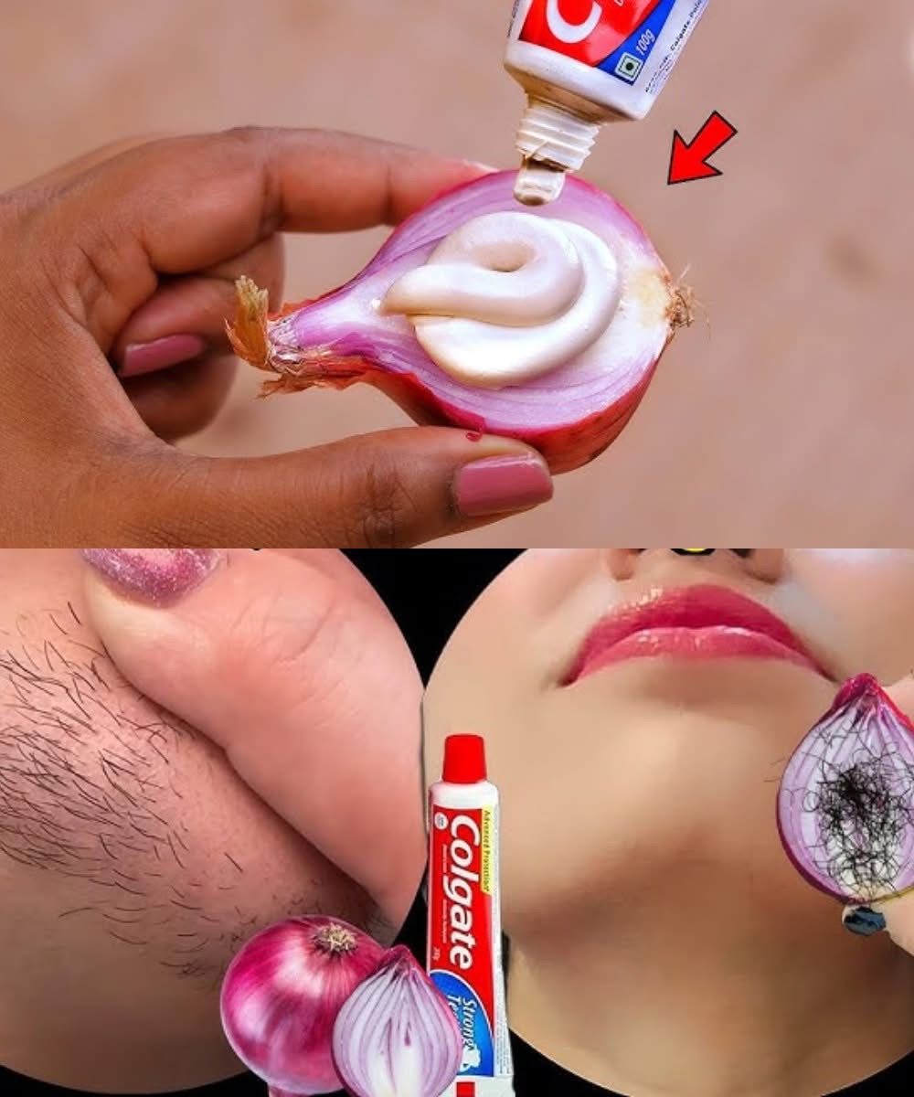 Pain-Free Hair Removal with Toothpaste & Onion