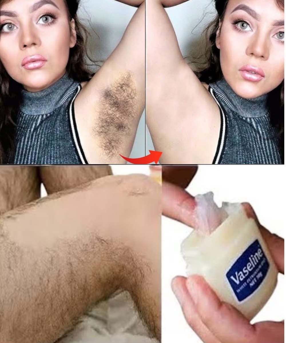Say Goodbye to Razor Burns: A Gentle DIY Vaseline Hair Removal Method