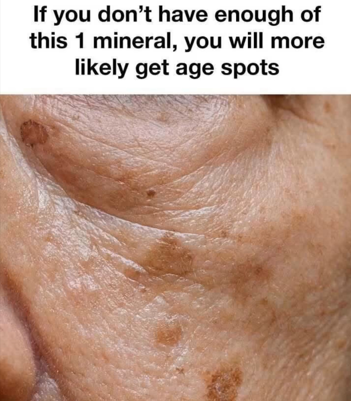 Erase Age Spots Naturally After 60 With This Little-Known Mineral