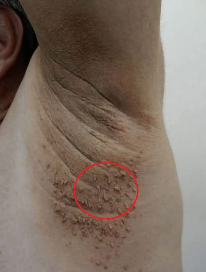 These are the first symptoms of cr…See more