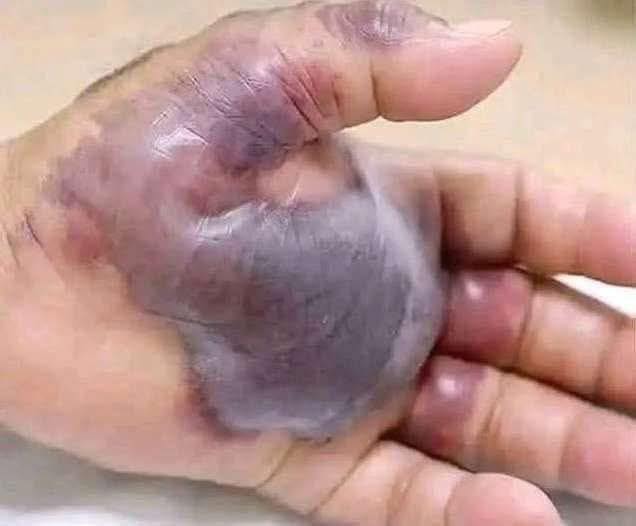 ATTENTION to these first signs of…